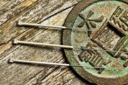depositphotos_15780067-stock-photo-acupuncture-needles-on-chinese-coin (1)